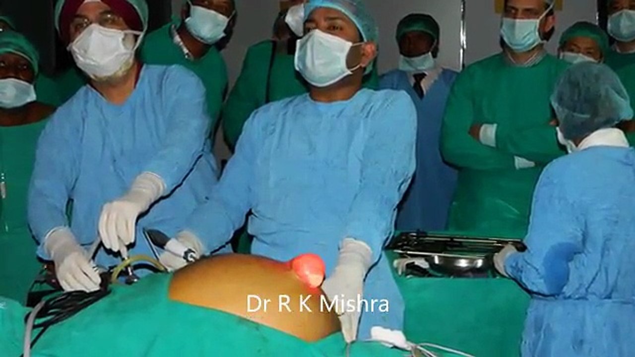Laparoscopic Repair of Para Umbilical Hernia by Dr R K Mishra