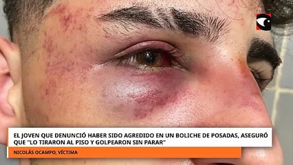 El joven que denunció haber sido agredido en un boliche de Posadas