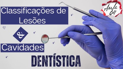Dentistica I /// AULA 04 - Classificações de Lesões e Cavidades - Odontologia Geral
