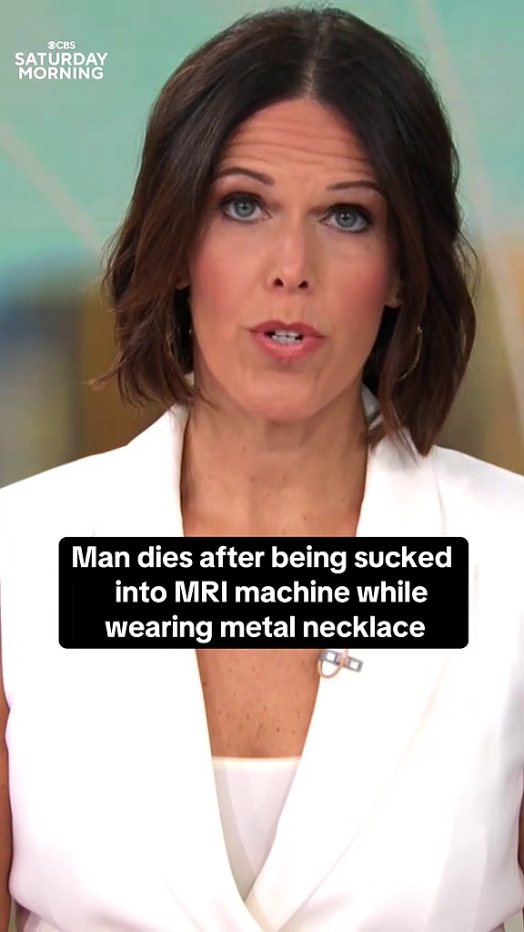 A man who was sucked into an MRI machine died from the severe injuries he suffered, police said.