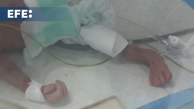 Bebes prematuros y desnutridos en Gaza por el bloqueo israelí