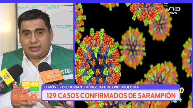 129 CASOS CONFIRMADOS DE SARAMPIÓN