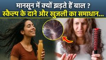 Itchy Scalp In Rainy Season:मानसून में बाल झड़ने और खुजली से कैसे बचें,Treatment In Hindi | Boldsky