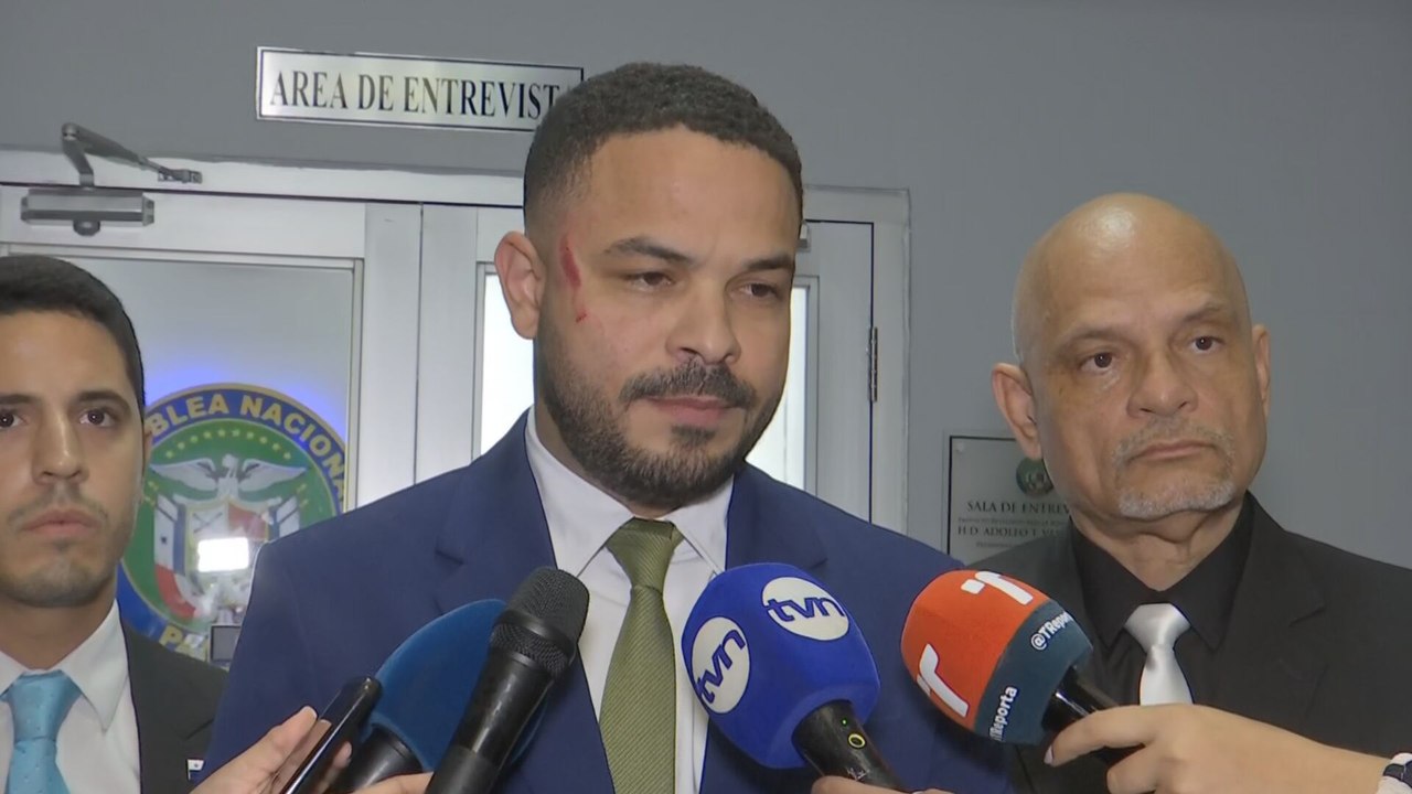 Diputado Betserai Richards denuncia agresión física por parte de 'Bolota' Salazar