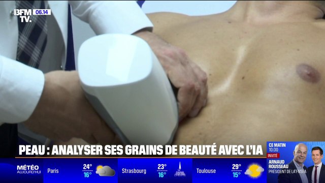 Santé: analyser ses grains de beauté avec l'IA pour détecter les cancers de la peau