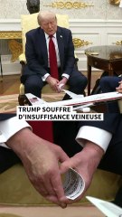 Trump souffre d'insuffisance veineuse
