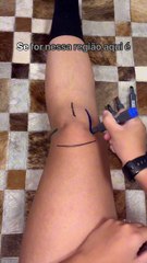 Seu joelho anda reclamando 🤨Dor, desconforto, aquele estalinho estranho… nem sempre é normal, v