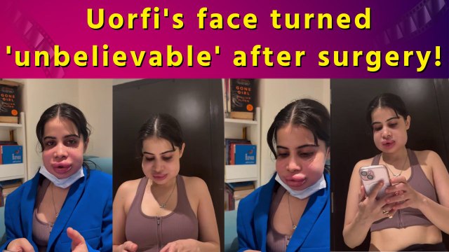 Uorfi Javed shares unfiltered filler dissolve video of herself with hilarious caption