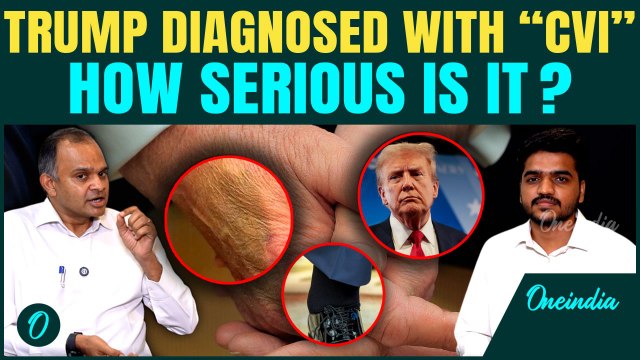 Trump Diagnosed with This Nerve Disorder, Doctor Explains How 'Dangerous' It Is | CVI Explained
