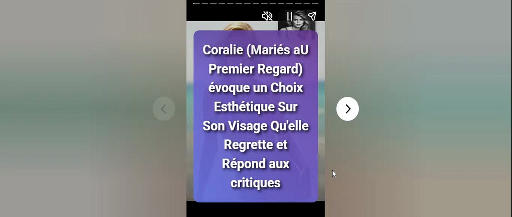 Coralie (Mariés aU Premier Regard) évoque un Choix Esthétique Sur Son Visage Qu'elle Regrette et Répond aux critiques