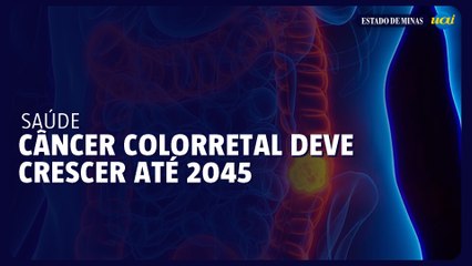 Casos de câncer colorretal devem crescer 75% na América do Sul até 2045