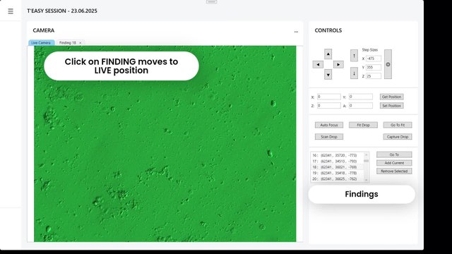 L'UZ Brussel teste un outil IA pour mieux détecter les spermatozoïdes dans les traitements de fertilité