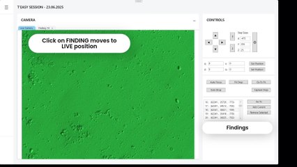L'UZ Brussel teste un outil IA pour mieux détecter les spermatozoïdes dans les traitements de fertilité