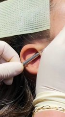 Not Your Basic Helix—This One’s Next Level! #forwardhelix #helixpiercing #earpiercing #nosepiercing