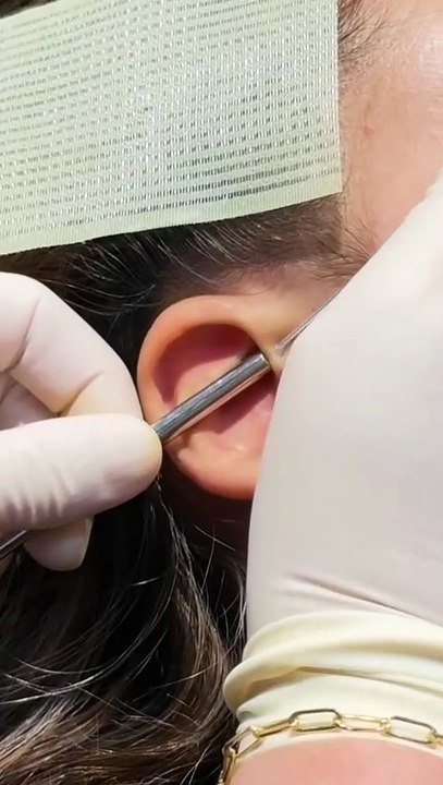 Not Your Basic Helix—This One’s Next Level! #forwardhelix #helixpiercing #earpiercing #nosepiercing