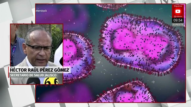 Aumentan casos de viruela del mono en Jalisco; van 60 contagios