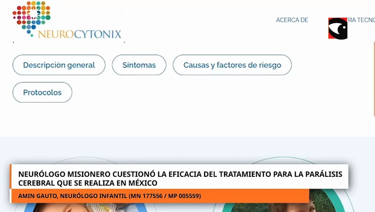 Neurólogo cuestionó la eficacia del tratamiento para la parálisis cerebral que se realiza en México