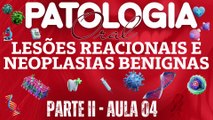 Patologia Oral II /// AULA 04 -  Lesões Reacionais e Neoplasias Benignas - Odontologia Geral