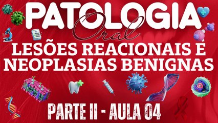 Patologia Oral II /// AULA 04 -  Lesões Reacionais e Neoplasias Benignas - Odontologia Geral