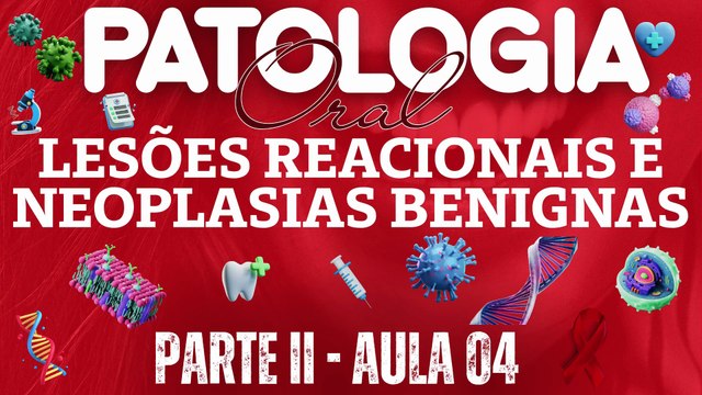 Patologia Oral II /// AULA 04 - Lesões Reacionais e Neoplasias Benignas - Odontologia Geral
