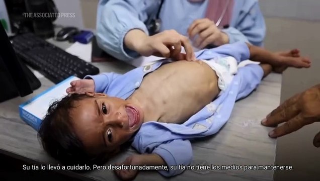 Mueren decenas de niños y adultos por hambre en Gaza durante julio