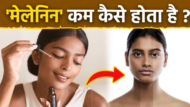 Melanin Kam Karne Ke Upay: मेलेनिन क्यों बढ़ता है,कम कैसे करें | Serum To Reduce | Boldsky