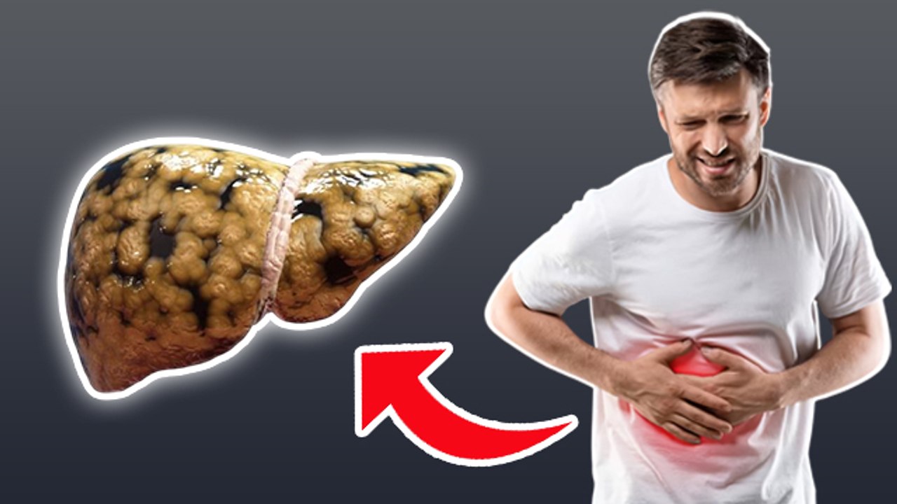 Is Grade 3 Fatty Liver Curable: क्या ग्रेड 3 का फैटी लिवर ठीक हो सकता है, Symptoms & Treatment...