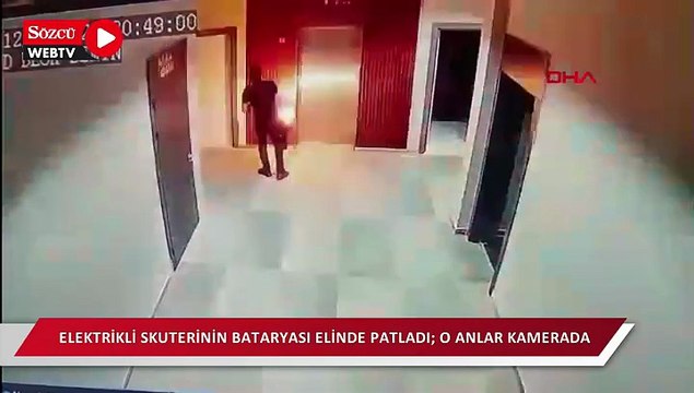 Elektrikli skuterinin bataryası elinde patladı; o anlar kamerada