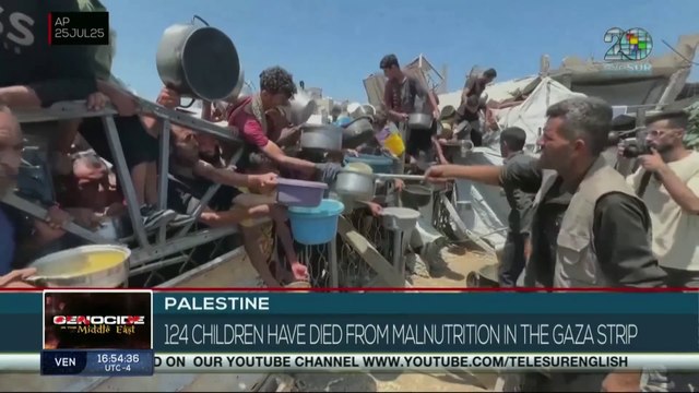 124 children have died from malnutrition in the Gaza Strip