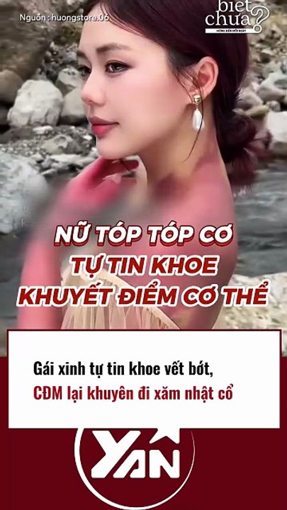 GÁI XINH tự tin khoe VẾT BỚT, CĐM lại khuyên đi XĂM NHẬT CỔ