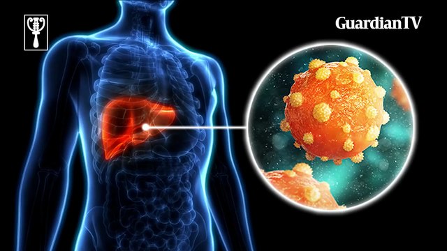 World Hepatitis Day: Understanding the risks, myths and safety measures