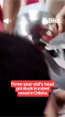 Baby's head stuck in vessel
