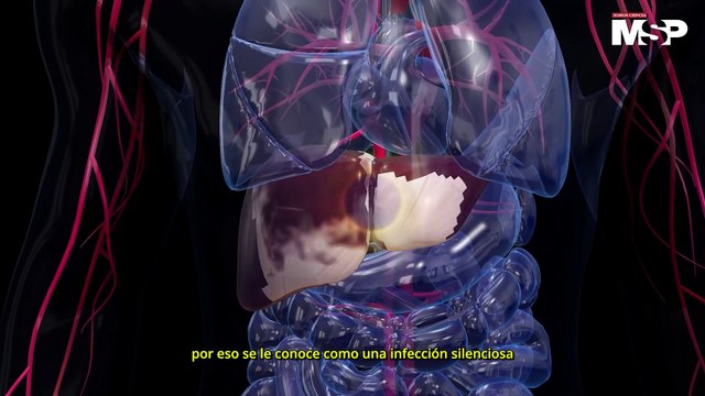 Sabías que la hepatitis C hoy puede tratarse y curarse con un medicamento oral