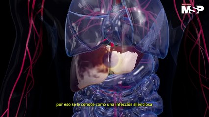 Sabías que la hepatitis C hoy puede tratarse y curarse con un medicamento oral