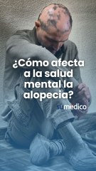 ¿Cómo afecta la alopecia a la salud mental?