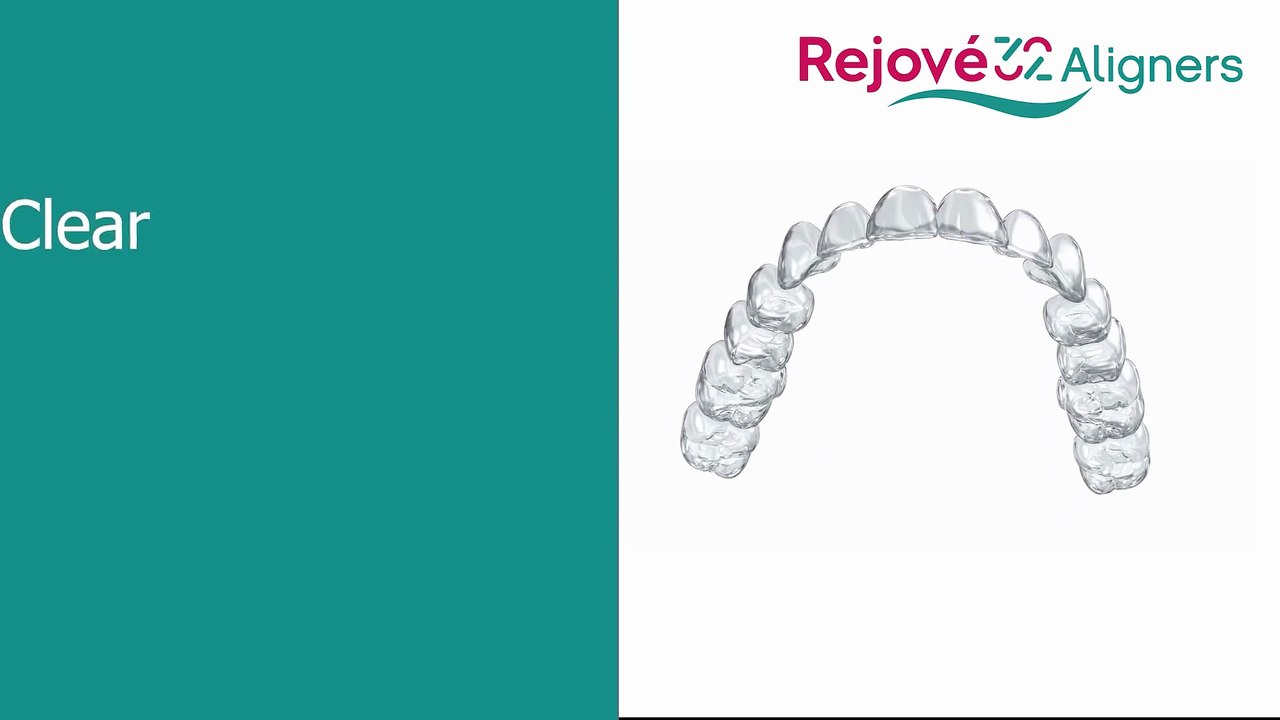 Invisible Aligners for Teeth Straightening