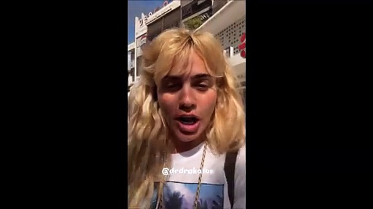 Κόνι Μεταξά: Έβγαλε το υαλουρονικό από τα τα χε...
