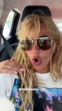 Η Κόνι Μεταξά για το υαλουρονικό που αφαίρεσε από τα χείλη της 2