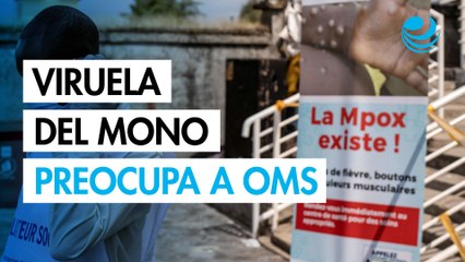 OMS alerta riesgo de contagio masivo por viruela del mono