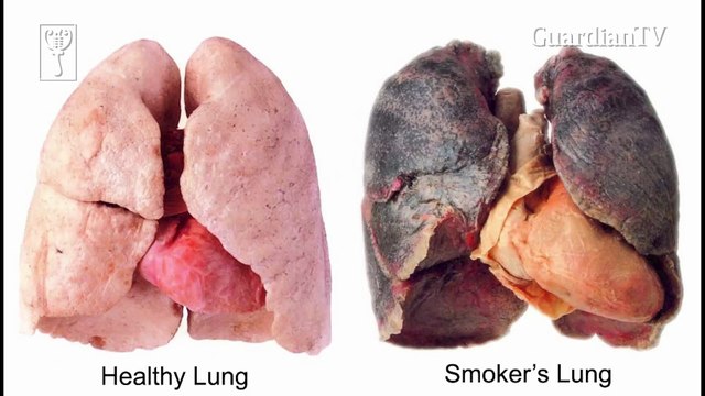 10 ways smoking destroys your body