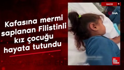 Gazze'de kafasına mermi saplanan Filistinli kız çocuğu, hayata tutundu