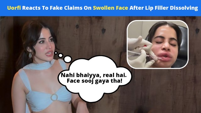 Uorfi Javed Hits Back At Fake Claims On Swollen Face After Getting Her Lip Fillers Dissolved