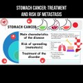 Stomach cancer: treatment and risk of metastasis