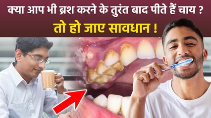 Can We Drink Tea After Brushing:ब्रश करने के तुरंत बाद चाय पीने से क्या होता है, Pieria-Damage Teeth