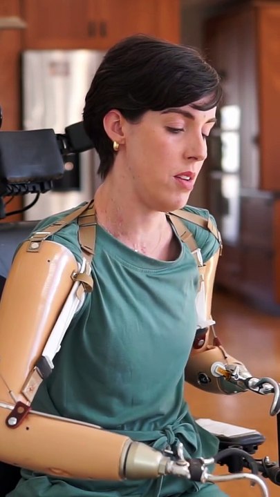 Ciara - tutorial on prosthetic arms