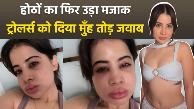 Urfi Javed Lip Filler Dissolve के बाद Share किया Transformation Video, Public Reaction Viral...