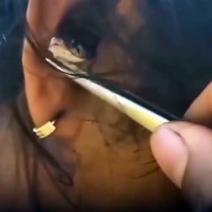 VÍDEO: Mulher é surpreendida com cobra dentro do ouvido