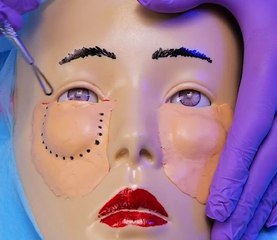 What to Expect During Lower Blepharoplasty Surgery 👁️