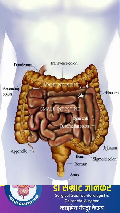 डिसिनेर्जिक डिफिकेशन (Dyssynergic defecation) म्हणजे काय_ जाणून घ्या सोप्या भाषेत - डॉ सम्राट जानकर
