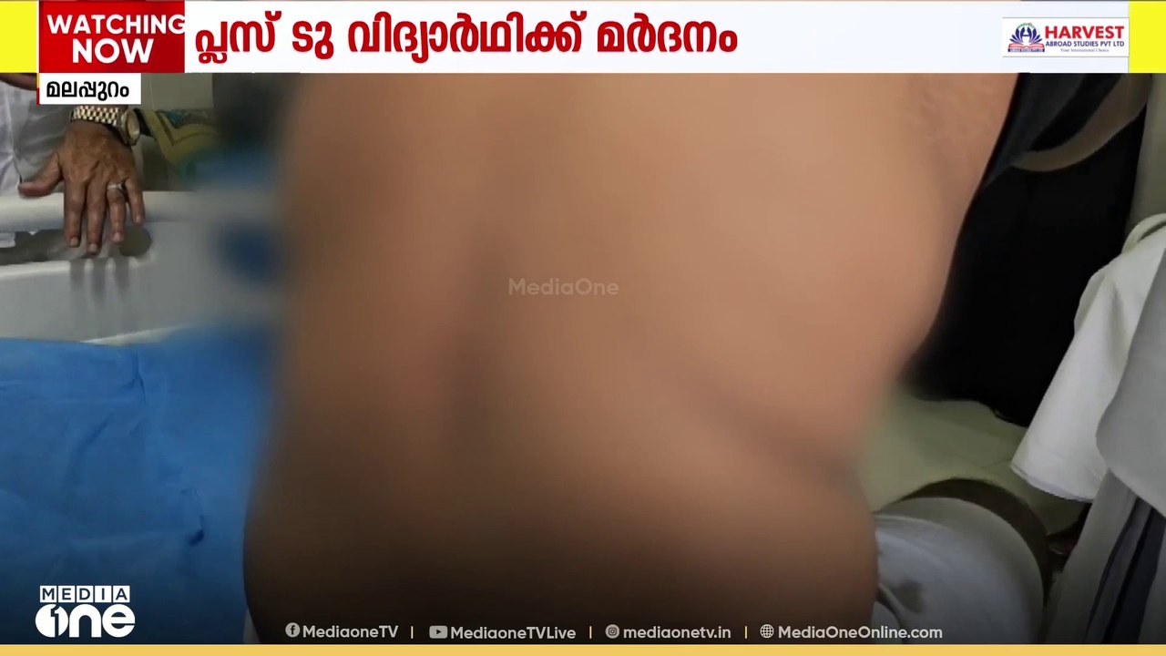വിദ്യാർഥിയെ വീട്ടിൽ നിന്ന് വിളിച്ചിറക്കി ഇരുമ്പ് വടി ഉപയോ​ഗിച്ച് മർദിച്ചു